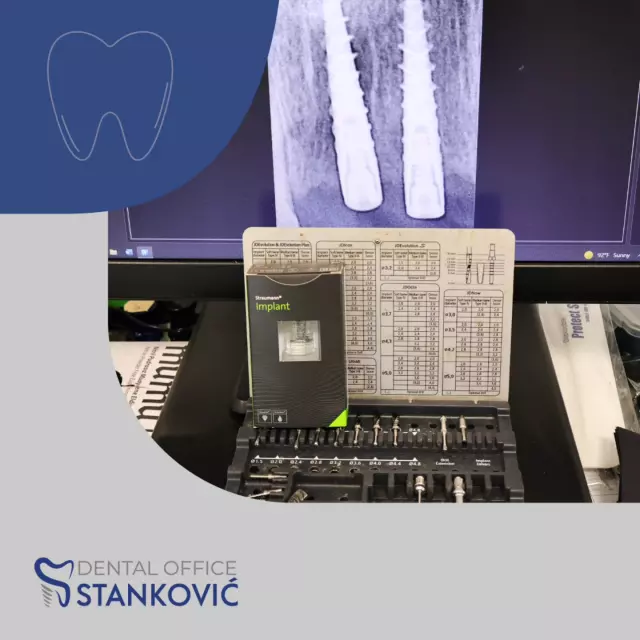 Stomatološka ordinacija Cetinje Podgorica Bar (6).jpg