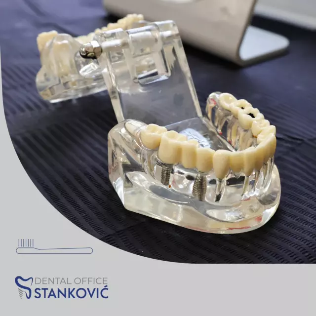 Stomatološka ordinacija Cetinje Podgorica Bar (7).jpg